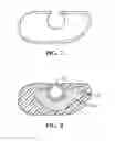 Fig. 08 - Wheelchair pin platform guard
