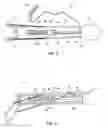 Fig. 03 - HIP TRACTION DEVICE, SYSTEM, AND METHODS