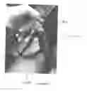Fig. 06 - Devices And Methods For Reducing The Symptoms Of Maladies Of The Vestibular System