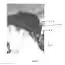 Fig. 07 - Devices And Methods For Reducing The Symptoms Of Maladies Of The Vestibular System