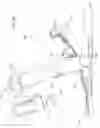 Fig. 10 - Uniform chest compression CPR