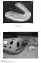 Fig. 03 - MULTI-PHASE ORAL COMPOSITION FOR TOOTH WHITENING