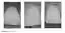 Fig. 04 - MULTI-PHASE ORAL COMPOSITION FOR TOOTH WHITENING