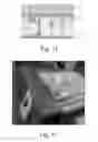 Fig. 07 - MULTI-PHASE ORAL COMPOSITION FOR TOOTH WHITENING