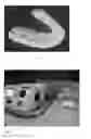 Fig. 03 - Multi-phase oral composition for tooth whitening
