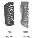 Fig. 35 - Degradable Microparticles for Protein and Small Molecule Delivery