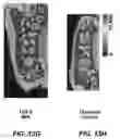 Fig. 37 - Degradable Microparticles for Protein and Small Molecule Delivery