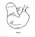 Fig. 03 - Methods and compositions for treating gastric ulcers