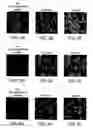 Fig. 08 - Treatment of CNS Disorders Associated with Mutations in Genes Encoding Lysosomal Enzymes