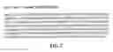 Fig. 16 - Treatment of CNS Disorders Associated with Mutations in Genes Encoding Lysosomal Enzymes
