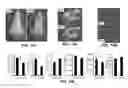Fig. 31 - METHODS AND MATERIALS FOR PROMOTING BONE FORMATION