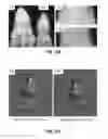 Fig. 32 - METHODS AND MATERIALS FOR PROMOTING BONE FORMATION
