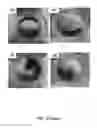 Fig. 35 - Mesoporous bioactive glasses and uses thereof