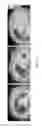 Fig. 29 - Method for enhancing insulin like growth factor 1 receptor expression of mesenchymal stem cell, method for isolating mesenchymal stem cell, and use of mesenchymal stem cell