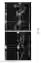 Fig. 37 - Method for enhancing insulin like growth factor 1 receptor expression of mesenchymal stem cell, method for isolating mesenchymal stem cell, and use of mesenchymal stem cell