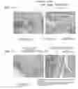 Fig. 12 - Suppressive agent for rheumatoid arthritis, prophylactic agent for rheumatoid arthritis, therapeutic agent for rheumatoid arthritis, and food for suppressing rheumatoid arthritis