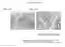 Fig. 13 - Suppressive agent for rheumatoid arthritis, prophylactic agent for rheumatoid arthritis, therapeutic agent for rheumatoid arthritis, and food for suppressing rheumatoid arthritis