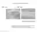 Fig. 15 - Suppressive agent for rheumatoid arthritis, prophylactic agent for rheumatoid arthritis, therapeutic agent for rheumatoid arthritis, and food for suppressing rheumatoid arthritis