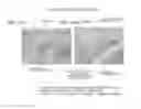 Fig. 16 - Suppressive agent for rheumatoid arthritis, prophylactic agent for rheumatoid arthritis, therapeutic agent for rheumatoid arthritis, and food for suppressing rheumatoid arthritis