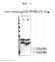 Fig. 04 - Method for treating eye diseases with a fusion protein of a tissue-penetrating peptide and anti-vascular endothelial growth factor