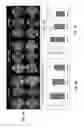 Fig. 08 - Method for treating eye diseases with a fusion protein of a tissue-penetrating peptide and anti-vascular endothelial growth factor
