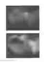 Fig. 06 - C-type natriuretic peptide agent for the treatment of alopecia
