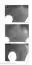 Fig. 09 - C-type natriuretic peptide agent for the treatment of alopecia