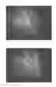 Fig. 32 - C-type natriuretic peptide agent for the treatment of alopecia