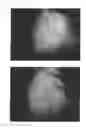Fig. 40 - C-type natriuretic peptide agent for the treatment of alopecia
