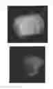 Fig. 41 - C-type natriuretic peptide agent for the treatment of alopecia