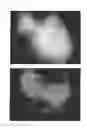 Fig. 44 - C-type natriuretic peptide agent for the treatment of alopecia