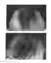 Fig. 46 - C-type natriuretic peptide agent for the treatment of alopecia