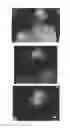 Fig. 47 - C-type natriuretic peptide agent for the treatment of alopecia