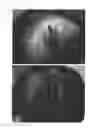 Fig. 48 - C-type natriuretic peptide agent for the treatment of alopecia