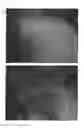 Fig. 50 - C-type natriuretic peptide agent for the treatment of alopecia