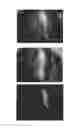 Fig. 53 - C-type natriuretic peptide agent for the treatment of alopecia
