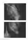 Fig. 58 - C-type natriuretic peptide agent for the treatment of alopecia