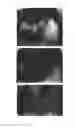 Fig. 64 - C-type natriuretic peptide agent for the treatment of alopecia