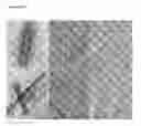 Fig. 15 - Compositions for remodeling extracellular matrix and methods of use thereof
