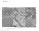 Fig. 16 - Compositions for remodeling extracellular matrix and methods of use thereof