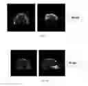 Fig. 04 - CONTRAST AGENTS FOR APPLICATIONS INCLUDING PERFUSION IMAGING