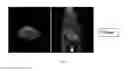 Fig. 05 - CONTRAST AGENTS FOR APPLICATIONS INCLUDING PERFUSION IMAGING
