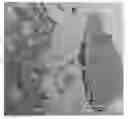 Fig. 01 - Implantable devices for bone or joint defects
