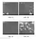 Fig. 09 - Implantable devices for bone or joint defects