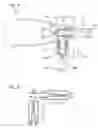 Fig. 05 - Constant pressure syringe for surgical use