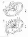 Fig. 20 - Dressing status detection for negative pressure wound therapy