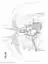Fig. 09 - Heart assist system and methods
