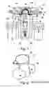 Fig. 02 - Catheter device, comprising a valve for controlling a fluid flow through a catheter