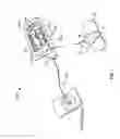 Fig. 10 - Operating an infusion pump system