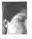 Fig. 15 - Self-administered injection device and method